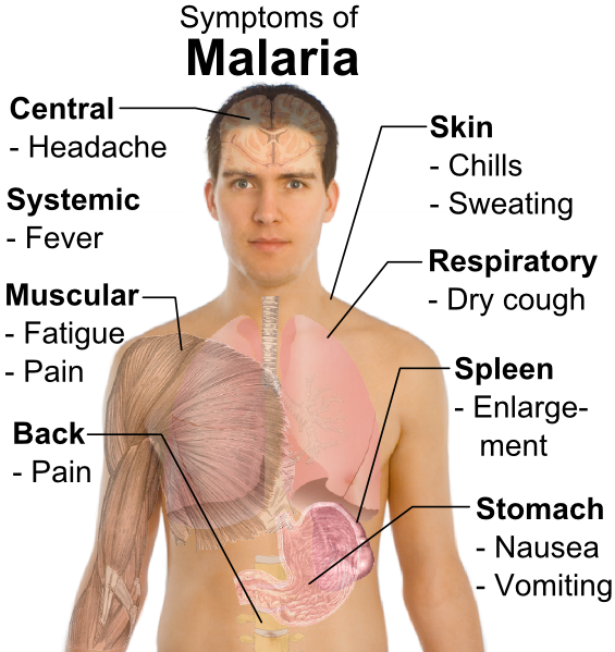 What Are The Symptoms Of Malaria?